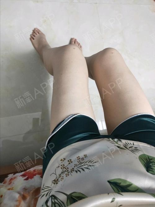 为什么最近女网红膝盖有伤